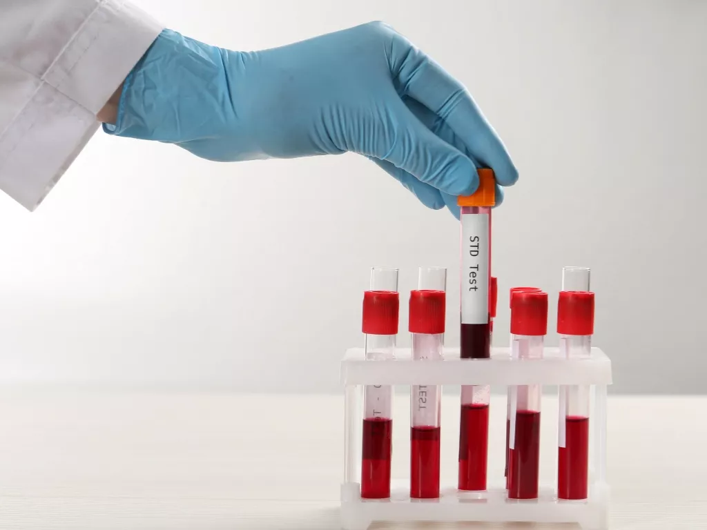 10 Panel STD Testing and Expert STD Care in Dubai at Cosmocare Medical Center