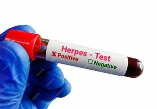 Herpes Testing and STD Dermatology Treatments in Dubai at Cosmocare Medical Center