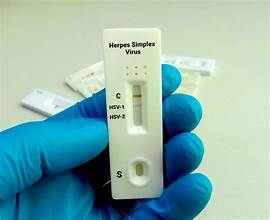 STD Lab Testing and Dermatology Treatments in Dubai at Cosmocare Medical Center