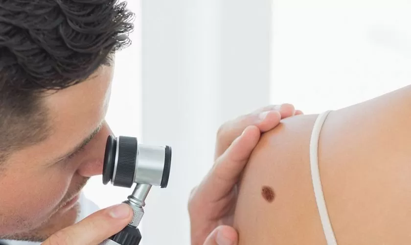 Expert Skin Cancer & Mole Removal Treatments in Dubai at Cosmocare Medical Center