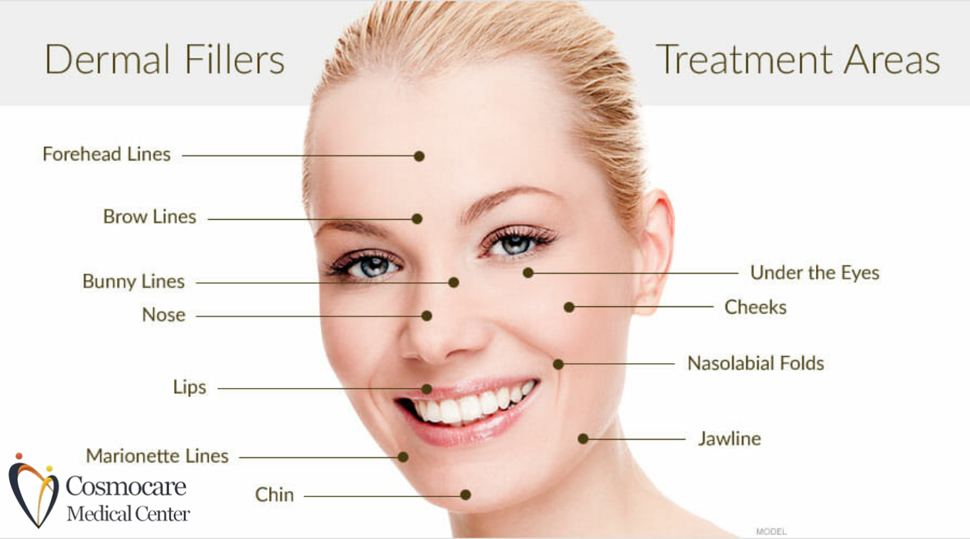 Dermal Facial Fillers Lip Filler Juvederm Filler Treatment In Dubai by Cosmocare Medical Center