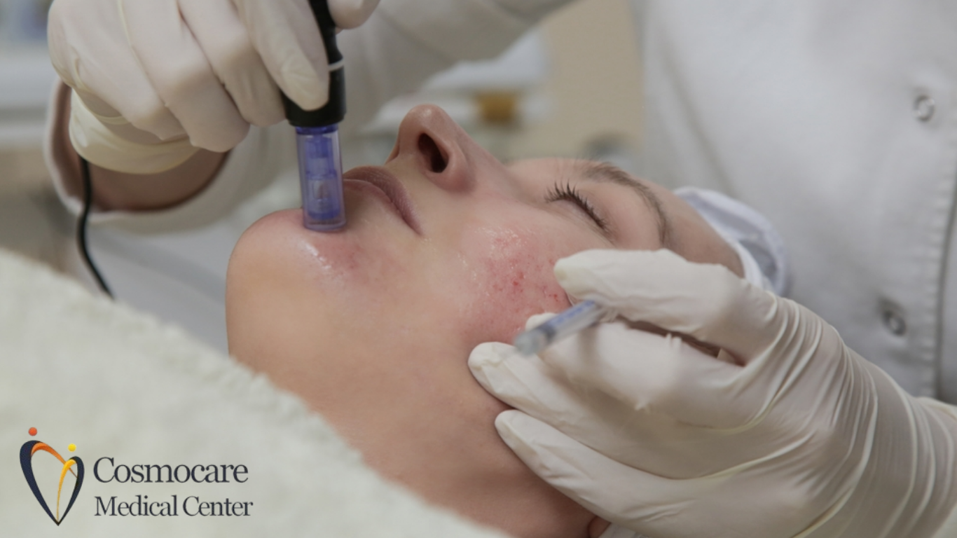 Dermapen Microneedling In Dubai by Cosmocare Medical Center